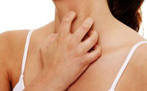 ����֢״ͼƬ ���Ӻ�ʪ�������